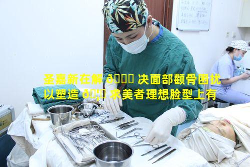 圣嘉新在解 🐕 决面部颧骨困扰以塑造 🦉 求美者理想脸型上有何妙招